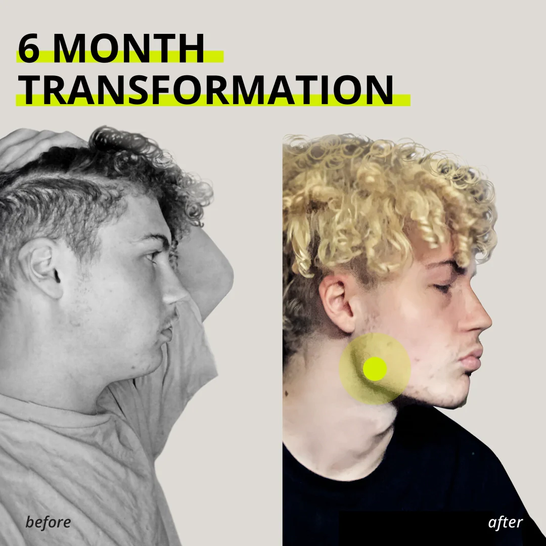 JAWLINER® Fitness Chewing Gum Cherry Ice - Image 14