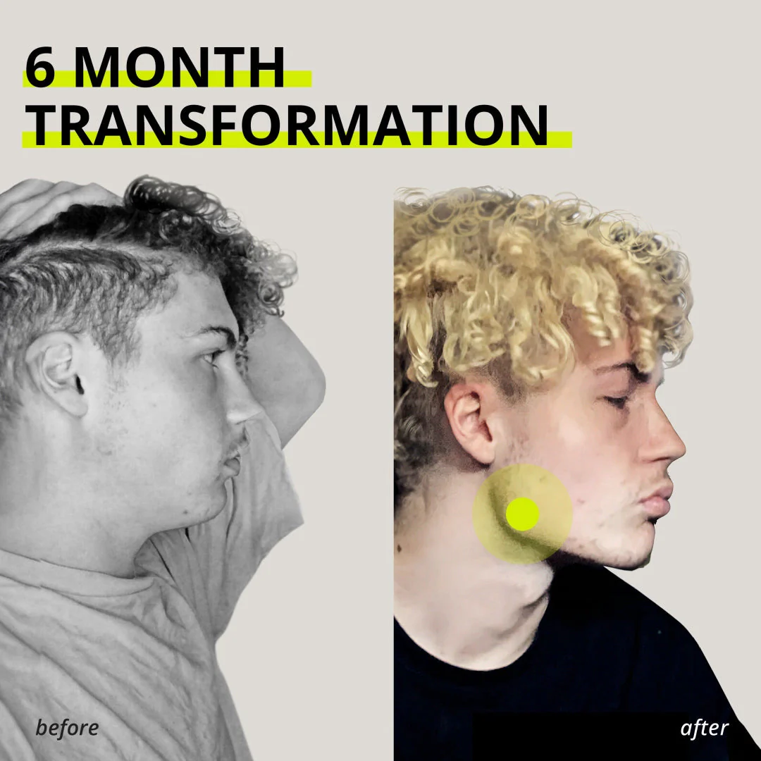 JAWLINER® Hard Chewing Gum - Image 22