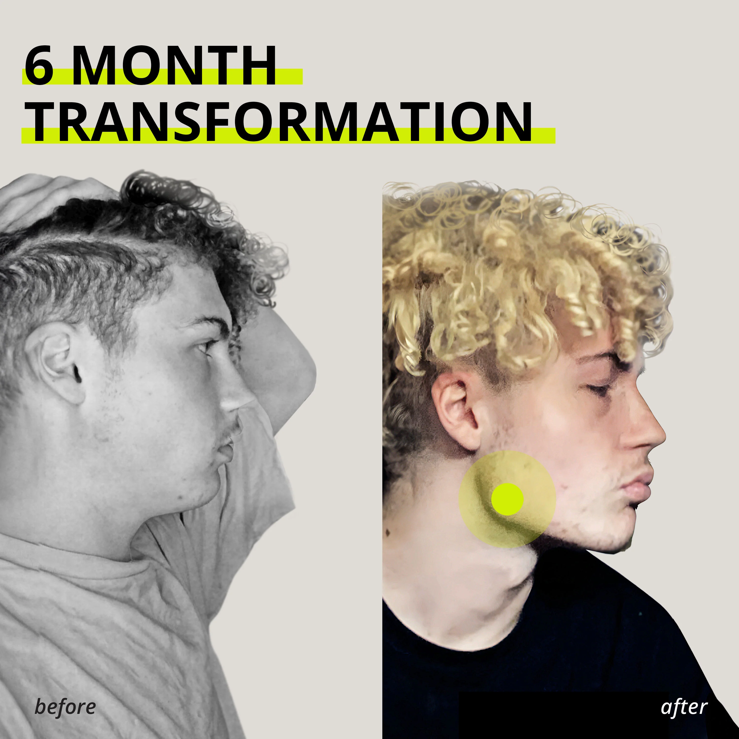 JAWLINER® Medium Chewing Gum Bundle Pack - Image 10