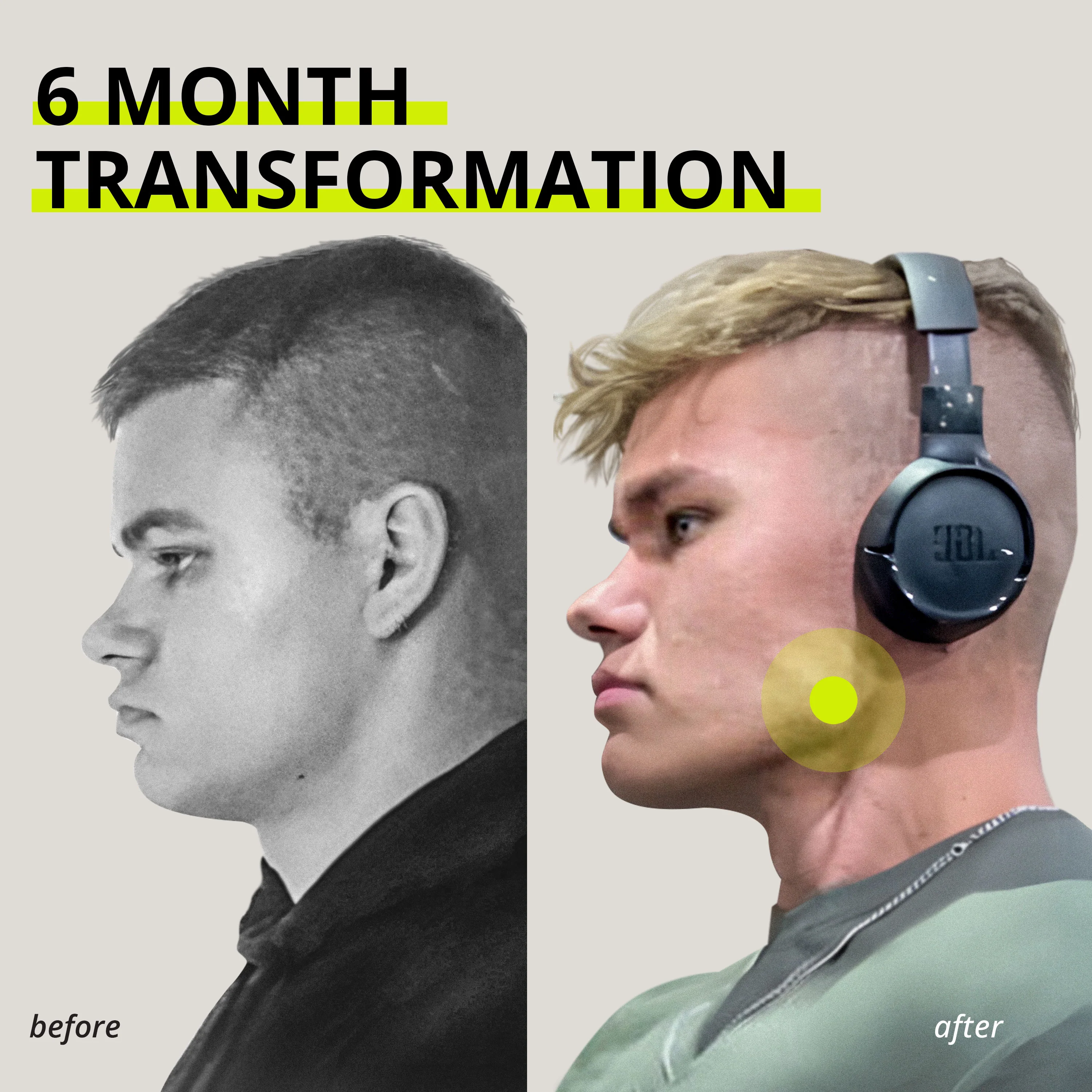 JAWLINER® Medium Chewing Gum Bundle Pack - Image 12