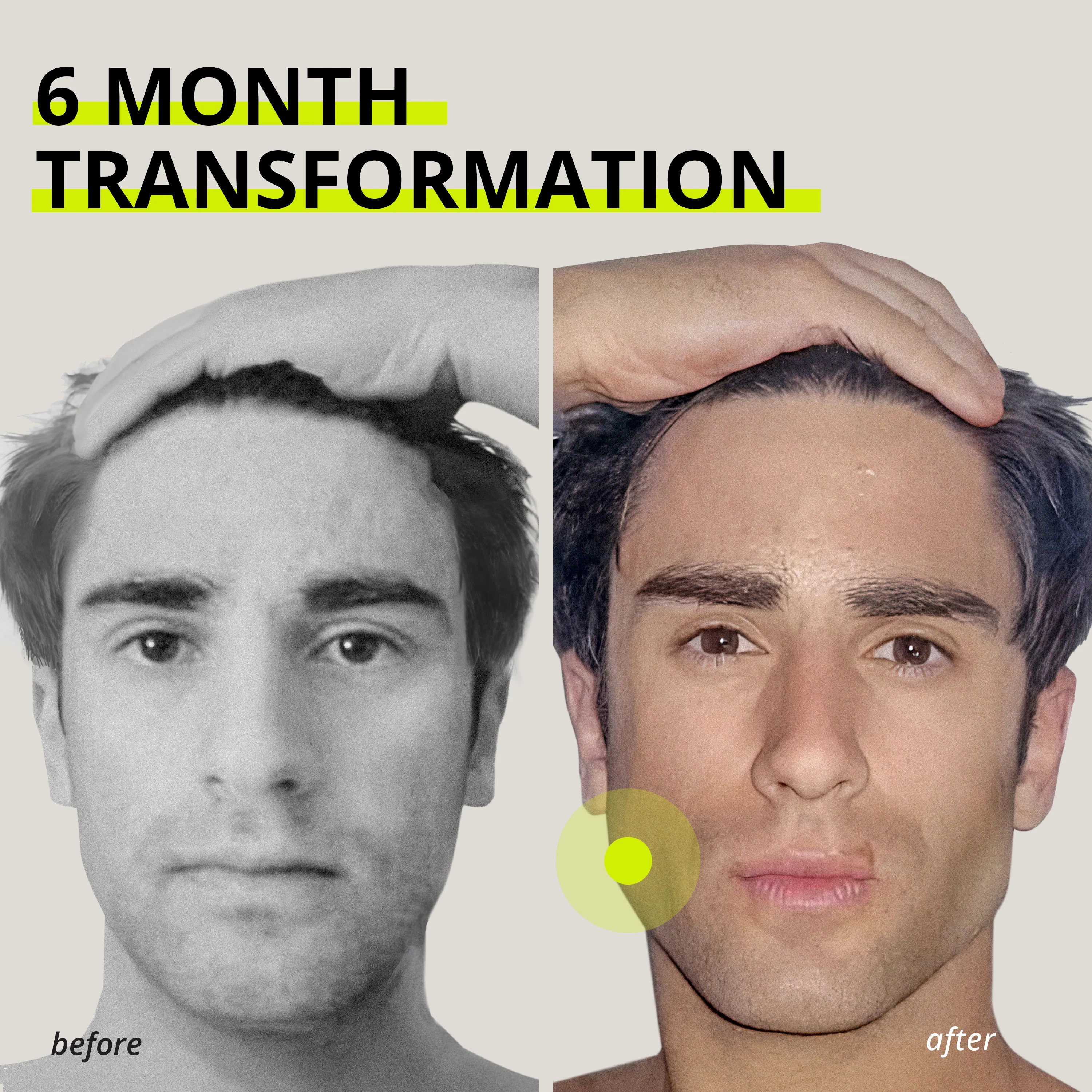 Medium-Hard Gum - Image 13